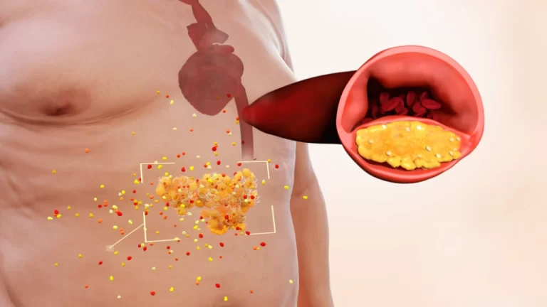 Inflammation illustration